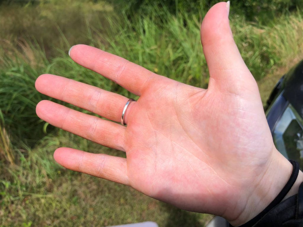 Hand After Climbing Orlando Tree Trek | Footsteps of a Dreamer